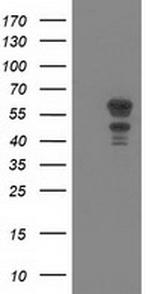 KATNAL1 Antibody in Western Blot (WB)