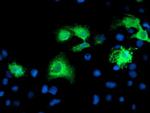 KATNB1 Antibody in Immunocytochemistry (ICC/IF)