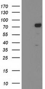 KATNB1 Antibody in Western Blot (WB)