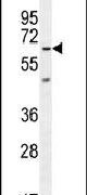 KBTBD5 Antibody in Western Blot (WB)