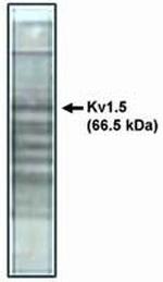 KV1.5 (KCNA5) Polyclonal Antibody