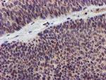 KCNAB1 Antibody in Immunohistochemistry (Paraffin) (IHC (P))