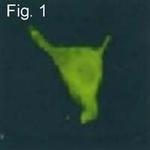 KCNH2 Antibody in Immunocytochemistry (ICC/IF)