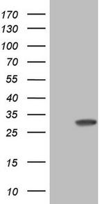 KCNIP2 Antibody in Western Blot (WB)
