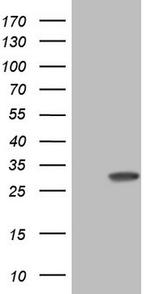 KCNIP2 Antibody in Western Blot (WB)