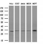 KCNIP2 Antibody in Western Blot (WB)
