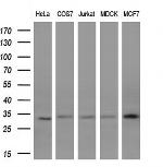 KCNIP2 Antibody in Western Blot (WB)