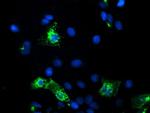 KCNJ3 Antibody in Immunocytochemistry (ICC/IF)