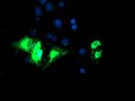 KCNJ3 Antibody in Immunocytochemistry (ICC/IF)