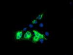 KCNJ3 Antibody in Immunocytochemistry (ICC/IF)