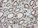 KCNJ3 Antibody in Immunohistochemistry (Paraffin) (IHC (P))