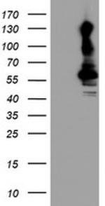 KCNJ3 Antibody in Western Blot (WB)