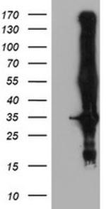KCNJ3 Antibody in Western Blot (WB)