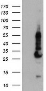 KCNJ3 Antibody in Western Blot (WB)