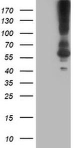 KCNJ3 Antibody in Western Blot (WB)