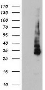 KCNJ3 Antibody in Western Blot (WB)