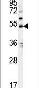 Kir3.2 (KCNJ6) Antibody in Western Blot (WB)
