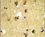 KCTD12 Antibody in Immunohistochemistry (IHC)