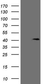 KCTD13 Antibody in Western Blot (WB)