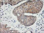 KCTD14 Antibody in Immunohistochemistry (Paraffin) (IHC (P))