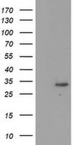 KCTD14 Antibody in Western Blot (WB)