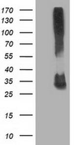 KCTD14 Antibody in Western Blot (WB)