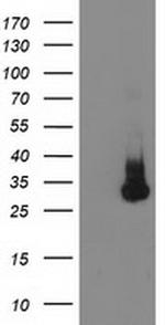 KCTD14 Antibody in Western Blot (WB)