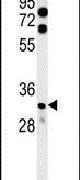 KCTD15 Antibody in Western Blot (WB)
