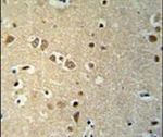 KCTD21 Antibody in Immunohistochemistry (IHC)