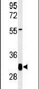 KCTD7 Antibody in Western Blot (WB)