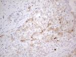 KCTD9 Antibody in Immunohistochemistry (Paraffin) (IHC (P))