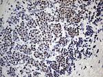 KDM3A Antibody in Immunohistochemistry (Paraffin) (IHC (P))