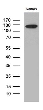 KDM3A Antibody in Western Blot (WB)