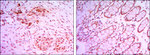 JMJD2A Antibody in Immunohistochemistry (Paraffin) (IHC (P))