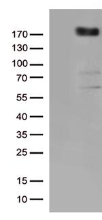 KDR Antibody in Western Blot (WB)