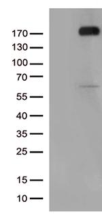 KDR Antibody in Western Blot (WB)