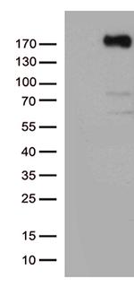 KDR Antibody in Western Blot (WB)