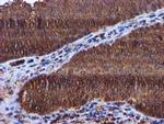 KEAP1 Antibody in Immunohistochemistry (Paraffin) (IHC (P))