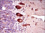 KEAP1 Antibody in Immunohistochemistry (Paraffin) (IHC (P))