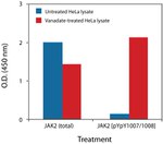 Human JAK2 (Total) ELISA Kit