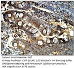 Ki67 Antibody in Immunohistochemistry (IHC)
