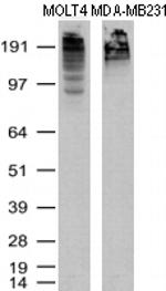 KI67 Antibody in Western Blot (WB)