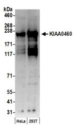 KIAA0460 Antibody in Western Blot (WB)