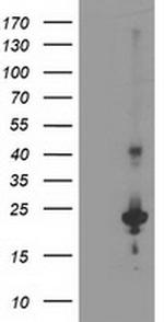 KIAA0495 Antibody in Western Blot (WB)