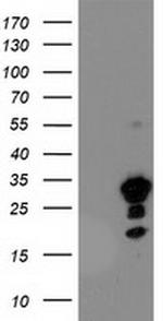 KIAA0495 Antibody in Western Blot (WB)