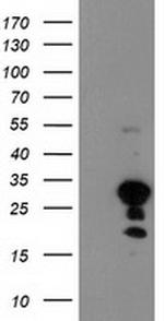KIAA0495 Antibody in Western Blot (WB)