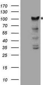 KIAA1524 Antibody in Western Blot (WB)