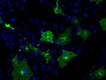 KIAA1609 Antibody in Immunocytochemistry (ICC/IF)