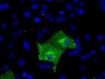 KIAA1609 Antibody in Immunocytochemistry (ICC/IF)