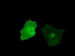 KIAA1609 Antibody in Immunocytochemistry (ICC/IF)
